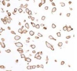 SIRP alpha/CD172a Antibody (BLR049F), Novus Biologicals 100 &mu;g | Buy Online | Bio-Techne | Fisher Scientific