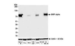 SIRP alpha/CD172a Antibody (BLR049F), Novus Biologicals 100 &mu;g | Buy Online | Bio-Techne | Fisher Scientific