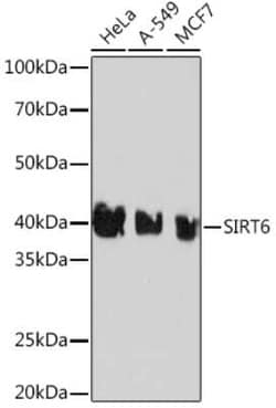 SIRT6 Rabbit anti-Human, Clone: 1D0L6, Novus Biologicals 20 &mu;g; Unconjugated:Antibodies,