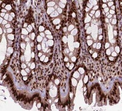 SIRT6 Antibody, Novus Biologicals:Antibodies:Primary Antibodies