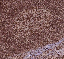 SIRT6 Antibody, Novus Biologicals:Antibodies:Primary Antibodies