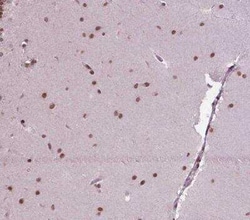SIRT6 Antibody, Novus Biologicals:Antibodies:Primary Antibodies