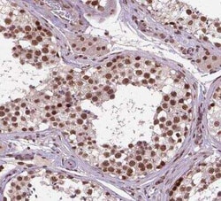 SIRT6 Antibody, Novus Biologicals:Antibodies:Primary Antibodies