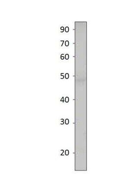 SIRT7 Antibody, Novus Biologicals 100 &mu;g | Buy Online | Bio-Techne | Fisher Scientific