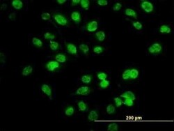 SIX4 Antibody (7E2), Novus Biologicals 0.1 mg | Buy Online | Novus Biologicals | Fisher Scientific