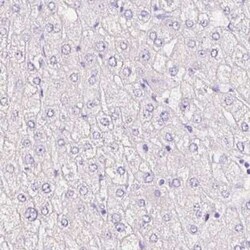 SIX1 Antibody (CL0185), Novus Biologicals 25 &mu;L | Buy Online | Novus Biologicals | Fisher Scientific