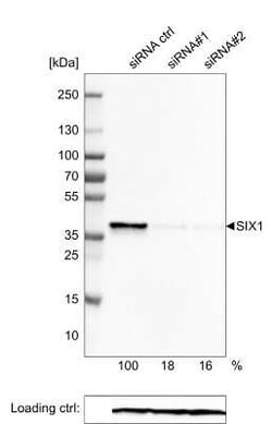SIX1 Antibody (CL0185), Novus Biologicals 25 &mu;L | Buy Online | Novus Biologicals | Fisher Scientific