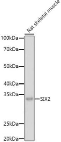 SIX2 Antibody - Azide and BSA Free, Novus Biologicals 0.1 mL; Unconjugated:Antibodies,