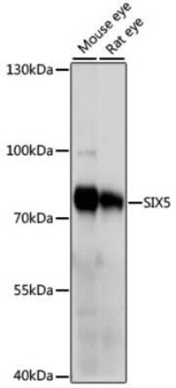 SIX5 Antibody - Azide and BSA Free, Novus Biologicals 0.02 mL | Buy Online | Novus Biologicals | Fisher Scientific