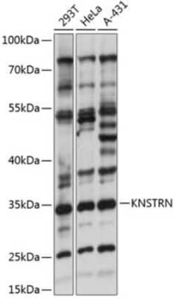SKAP Antibody - Azide and BSA Free, Novus Biologicals:Antibodies:Primary