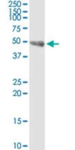 SKIP Antibody (3B4), Novus Biologicals 0.1 mg | Buy Online | Novus Biologicals | Fisher Scientific