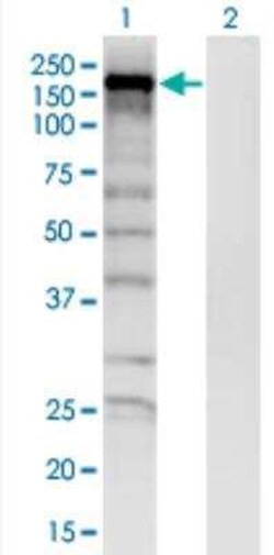SKIV2L Antibody (1E5), Novus Biologicals 50 &mu;g;, Unconjugated:Antibodies,