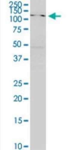 SKIV2L Antibody (1E5), Novus Biologicals 50 &mu;g;, Unconjugated:Antibodies,