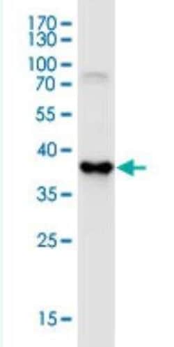 SKIV2L Antibody (1E5), Novus Biologicals 50 &mu;g;, Unconjugated:Antibodies,