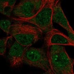 SKIV2L Rabbit anti-Human, Polyclonal, Novus Biologicals 100 &mu;g; Unconjugated:Antibodies,