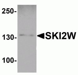 SKIV2L Antibody - BSA Free, Novus Biologicals 0.1 mg | Buy Online | Novus Biologicals | Fisher Scientific