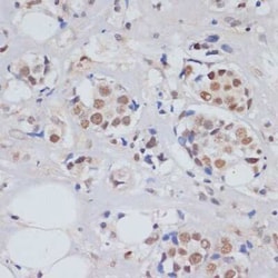 SKIV2L2 Antibody - BSA Free, Novus Biologicals:Antibodies:Primary Antibodies