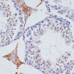 SKIV2L2 Antibody - BSA Free, Novus Biologicals:Antibodies:Primary Antibodies