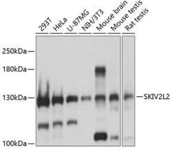 SKIV2L2 Antibody - BSA Free, Novus Biologicals:Antibodies:Primary Antibodies