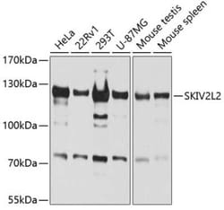 SKIV2L2 Antibody - BSA Free, Novus Biologicals:Antibodies:Primary Antibodies
