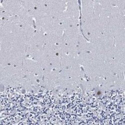 SKOR1 Rabbit anti-Human, Polyclonal, Novus Biologicals 25 &mu;g; Unconjugated:Antibodies,