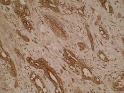 SLA2 Antibody (Z30P1F12 F4) - BSA Free, Novus Biologicals 0.025 mL, Unconjugated:Antibodies,