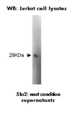SLA2 Antibody (Z30P1F12 F4) - BSA Free, Novus Biologicals 0.025 mL, Unconjugated:Antibodies,