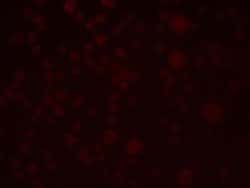 SLAIN1 Antibody - BSA Free, Novus Biologicals 0.1 mg; Unconjugated:Antibodies,
