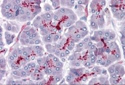 SLAIN1 Antibody - BSA Free, Novus Biologicals 0.1 mg; Unconjugated:Antibodies,