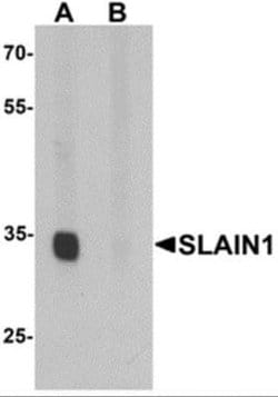 SLAIN1 Antibody - BSA Free, Novus Biologicals 0.1 mg; Unconjugated:Antibodies,