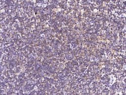 SLAM/CD150 Rabbit anti-Human, Clone: 8, Novus Biologicals 100 &mu;g | Buy Online | Novus Biologicals | Fisher Scientific