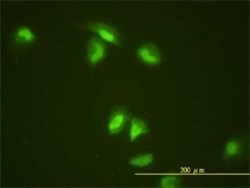 SLBP Antibody (2C4-1C8), Novus Biologicals 0.1 mg | Buy Online | Novus Biologicals | Fisher Scientific