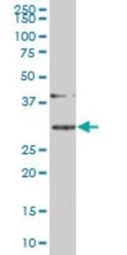 SLBP Antibody (2C4-1C8), Novus Biologicals 0.1 mg | Buy Online | Novus Biologicals | Fisher Scientific