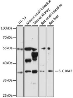 SLC10A2 Antibody - Azide and BSA Free, Novus Biologicals 0.1 mL, Unconjugated:Antibodies,