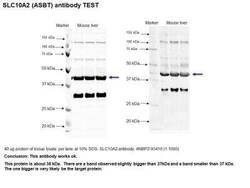 SLC10A2 Antibody - Azide and BSA Free, Novus Biologicals 0.1 mL, Unconjugated:Antibodies,