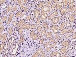 SLC13A1 Antibody, Novus Biologicals:Antibodies:Primary Antibodies