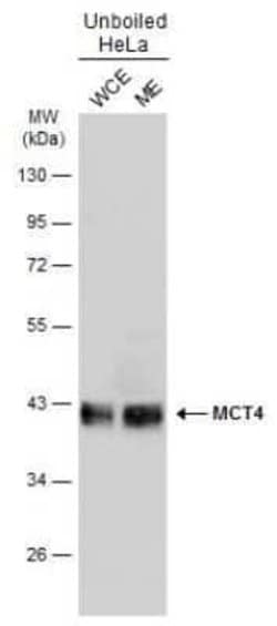 SLC16A3 Antibody, Novus Biologicals 100 &mu;g | Buy Online | Novus Biologicals | Fisher Scientific