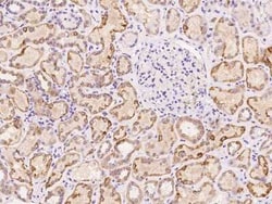 SLC16A4 Antibody, Novus Biologicals 100 &mu;g, Unconjugated:Antibodies,