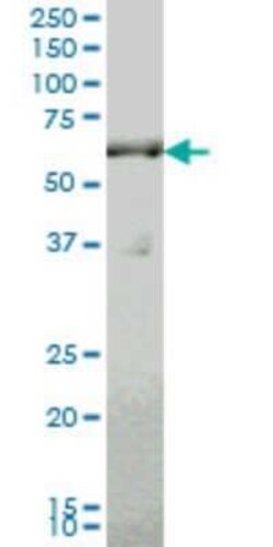 SLC19A2 Antibody (5B10), Novus Biologicals 0.1 mg | Buy Online | Novus Biologicals | Fisher Scientific