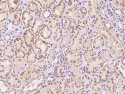 SLC19A3 Antibody, Novus Biologicals 50 &mu;g, Unconjugated:Antibodies,