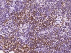 SLC1A4 Antibody, Novus Biologicals 50 &mu;g, Unconjugated:Antibodies, Polyclonal
