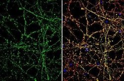 SLC1A7 Antibody, Novus Biologicals 100 &mu;g | Buy Online | Novus Biologicals | Fisher Scientific