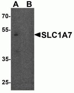 SLC1A7 Antibody - BSA Free, Novus Biologicals 0.1 mg; Unconjugated:Antibodies,