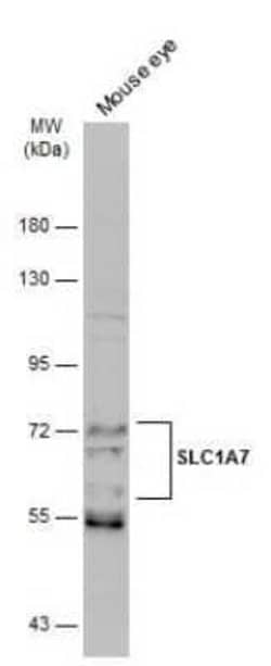 SLC1A7 Antibody, Novus Biologicals 100 &mu;g | Buy Online | Novus Biologicals | Fisher Scientific