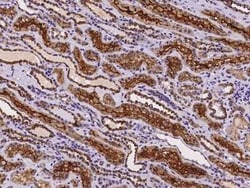 SLC22A12 Antibody, Novus Biologicals 50 &mu;g, Unconjugated:Antibodies,