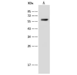 SLC22A12 Antibody, Novus Biologicals 50 &mu;g; Unconjugated:Antibodies,