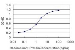 SLC22A13 Antibody (1E6), Novus Biologicals 0.1 mg | Buy Online | Novus Biologicals | Fisher Scientific