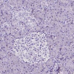 SLC22A2/OCT2 Antibody (CL0628), Novus Biologicals 25 &mu;L, Unconjugated:Antibodies,