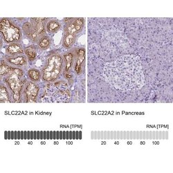 SLC22A2/OCT2 Antibody (CL0628), Novus Biologicals 25 &mu;L, Unconjugated:Antibodies,
