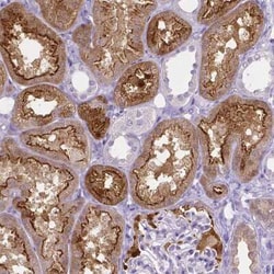 SLC22A2/OCT2 Antibody (CL0631), Novus Biologicals 25 &mu;L, Unconjugated:Antibodies,